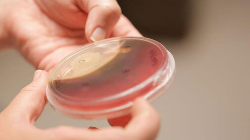 Hands holding a petri dish with red media and a patch of bacteria